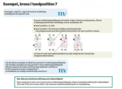 Exempel, krona i tandposition 7
