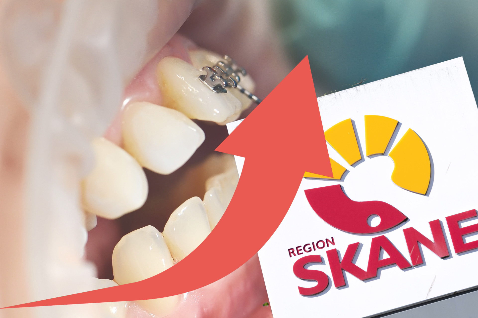 Skåne sticker ut i ortodontiurvalet