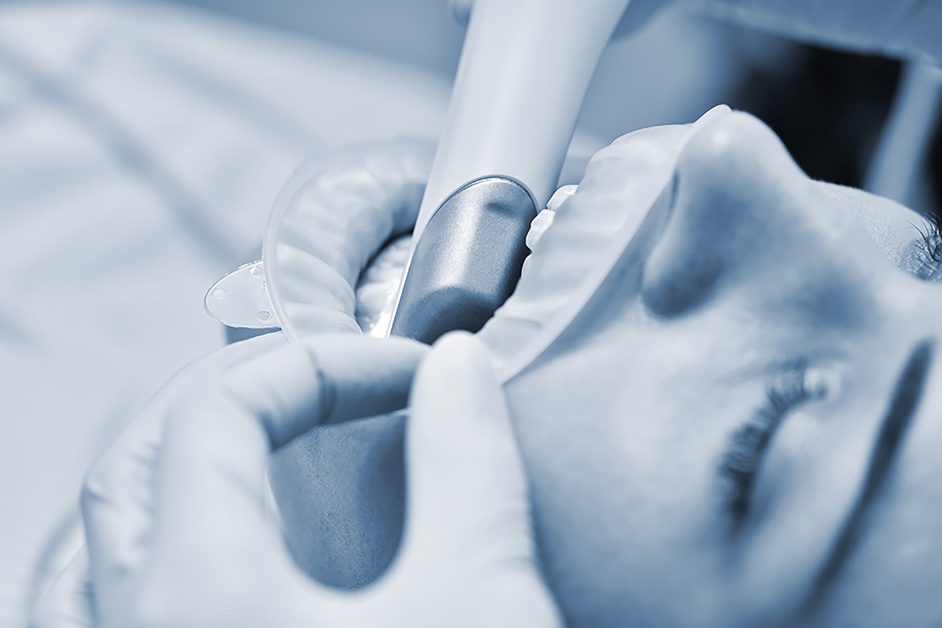 Ivo kritiserar alltför utdragen skanning