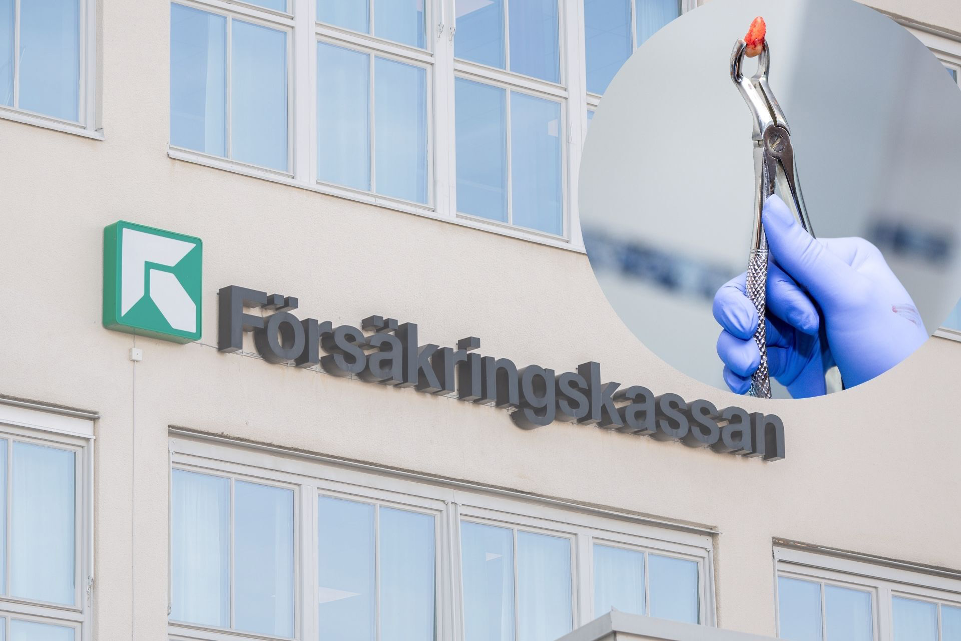 Försäkringskassan ökar kontrollen av tandvårdsstödet