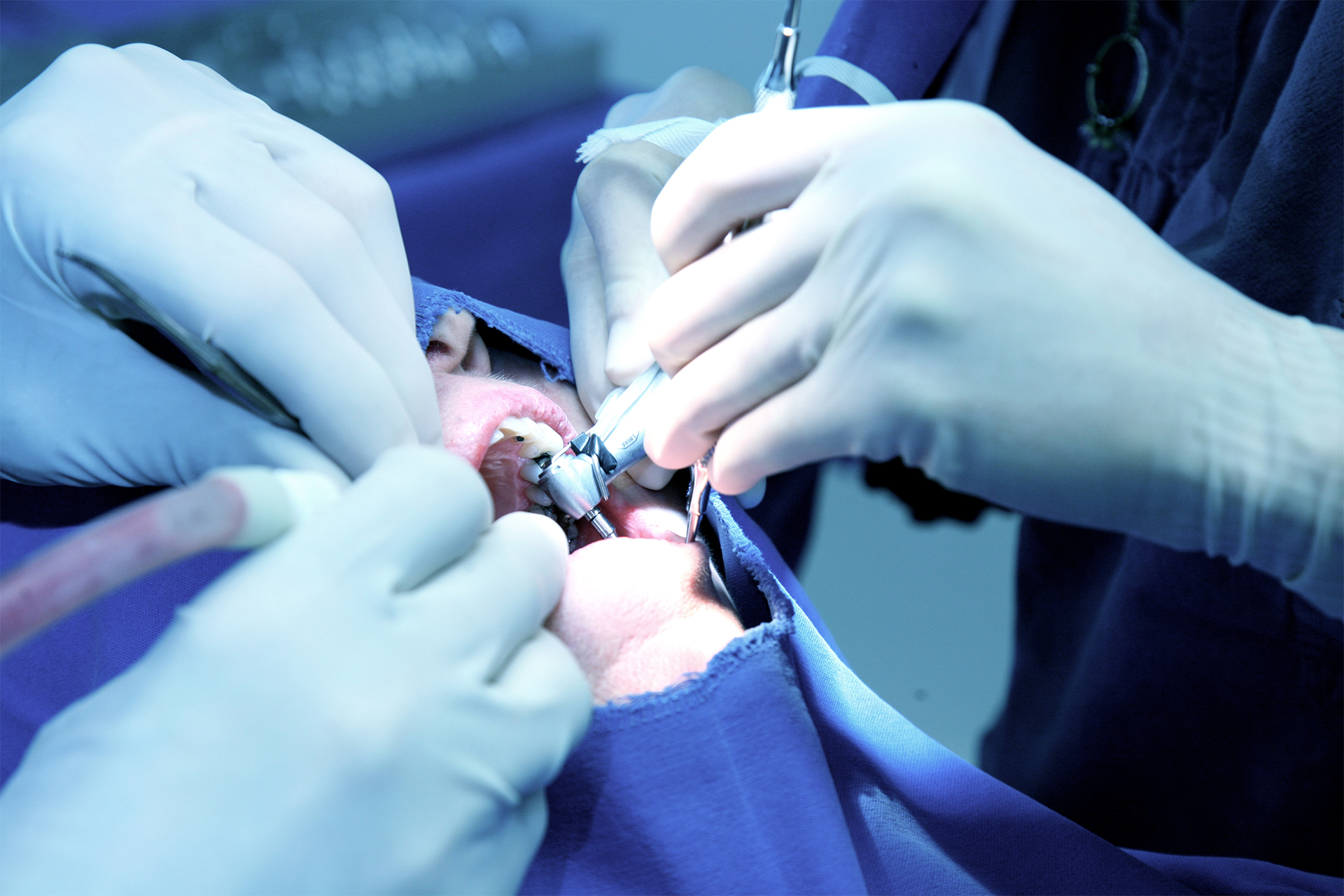 Kritiseras efter kronbehandling – patient fick perforerad tandrot