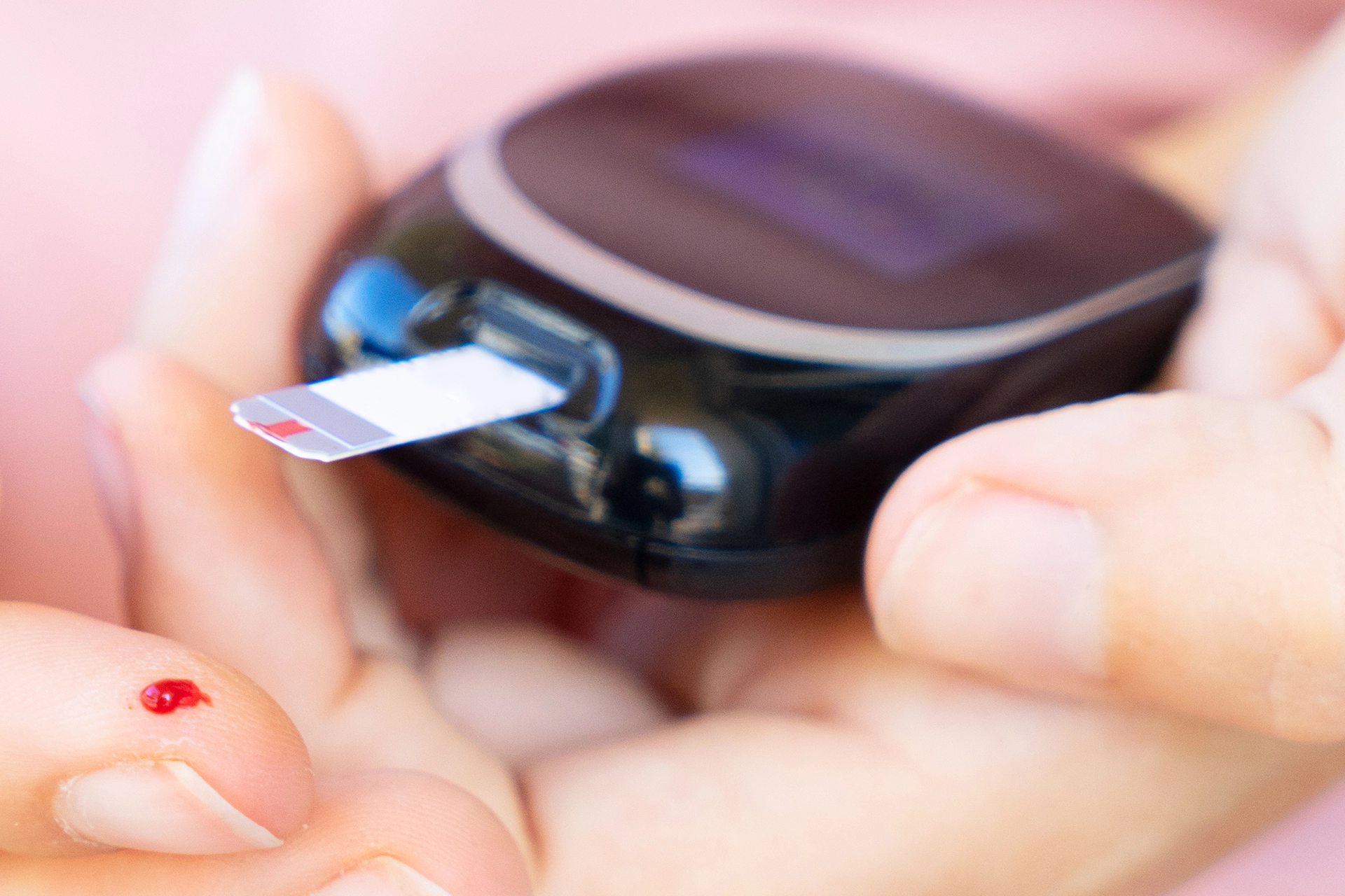 Långsiktig implantatframgång kräver stabil blodsockerkontroll vid diabetes